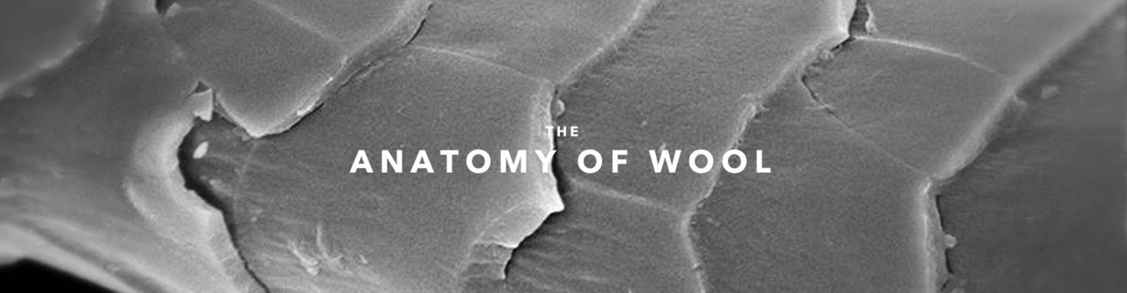 woolmicroscope Squadratlantica
